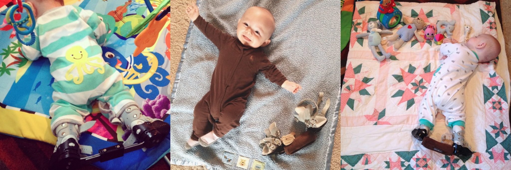 Clubfoot baby shop must haves